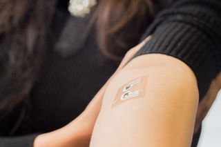 This device is a temporary electronic "tattoo" that researchers say could one day let people with diabetes test their blood sugar levels without pain.