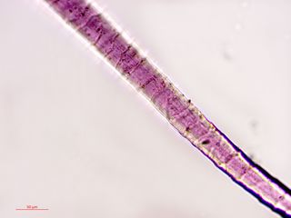 A single strand of dyed fabric photographed under a microscope.