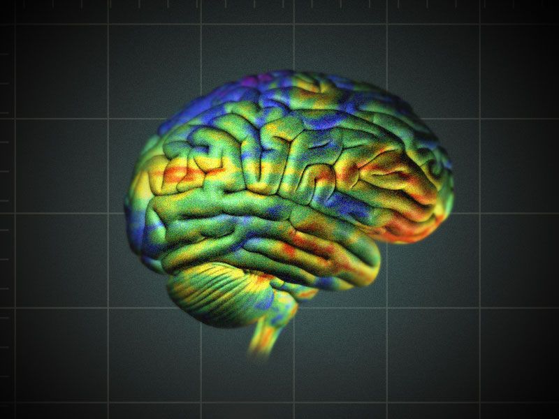 A diagram of the brain highlights different regions with different colors. 