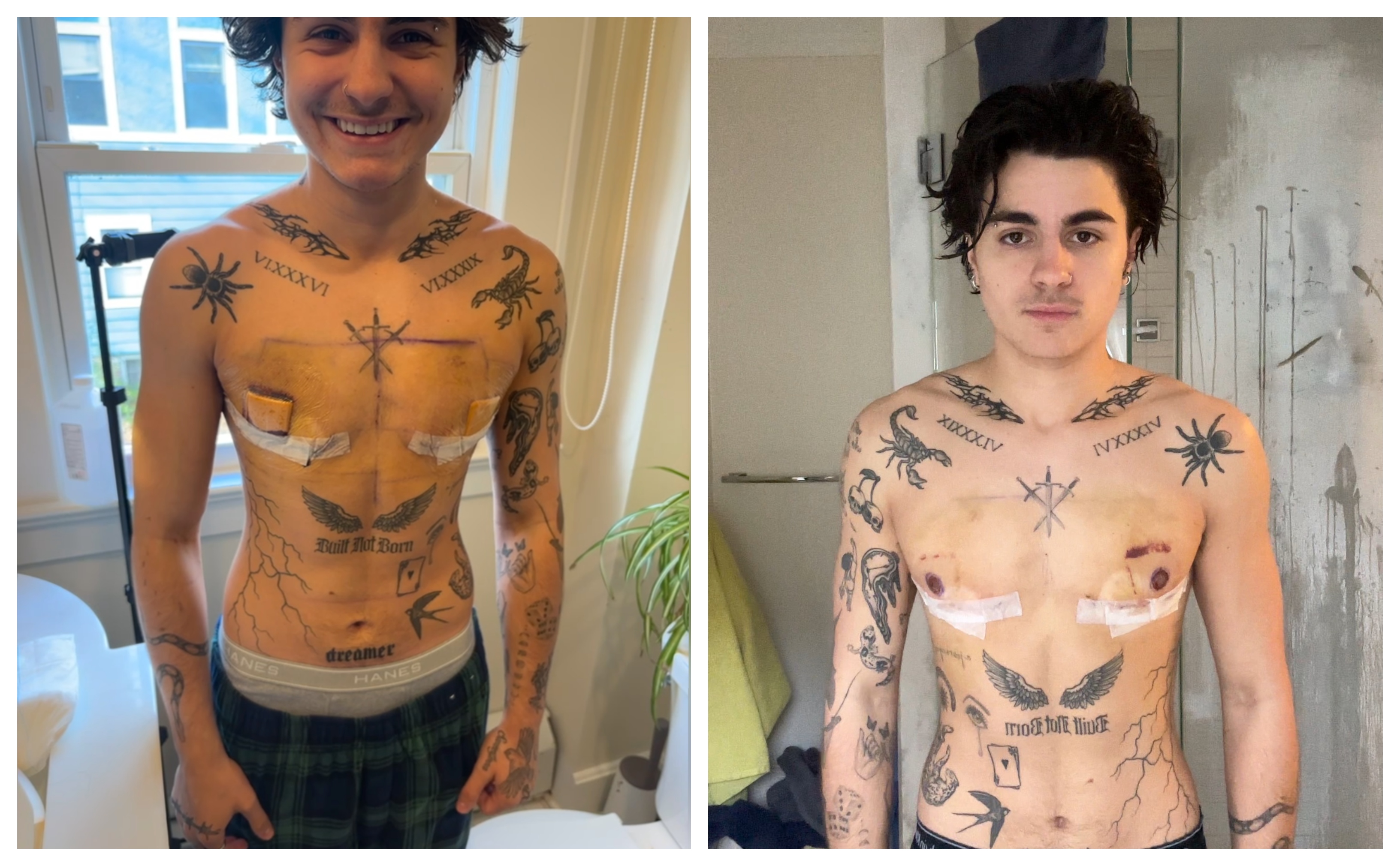 a young man with tattoos with tape over his chest on the left and on the right in brighter lighting