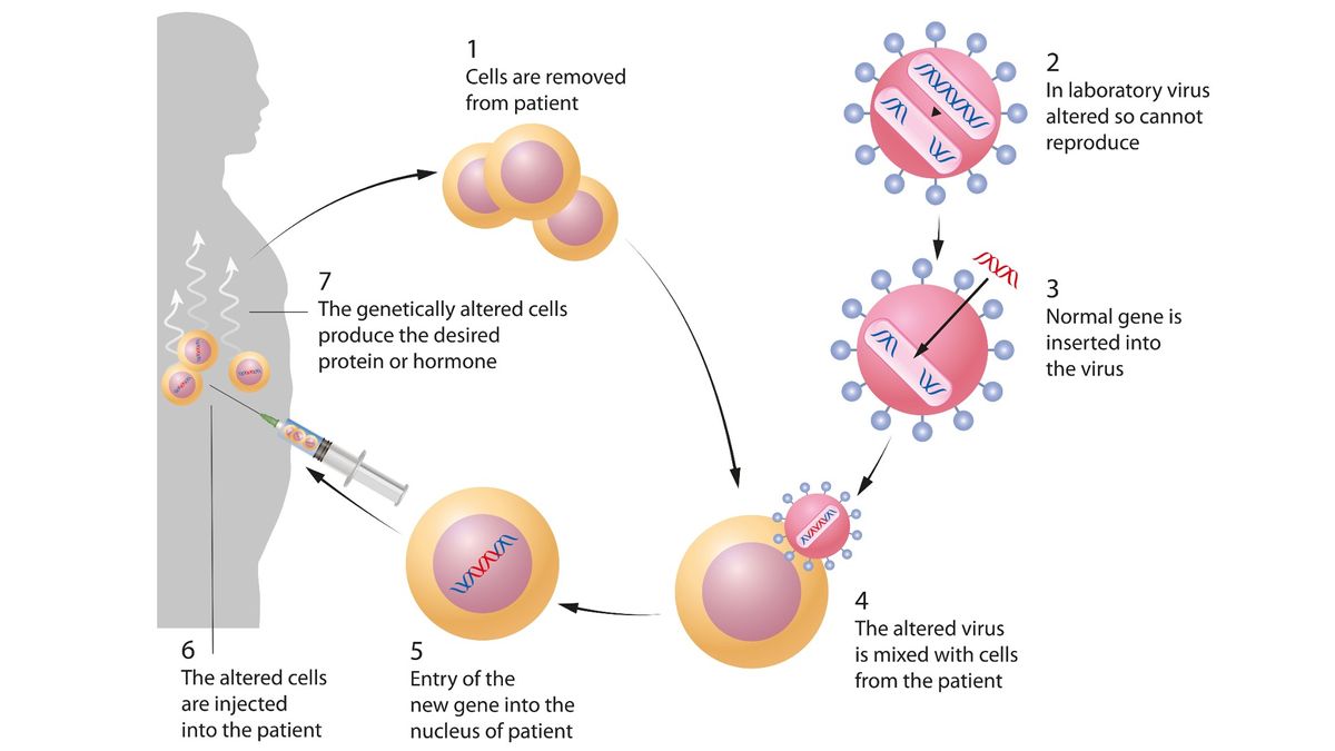 Gene therapy What is it and how does it work? Live Science