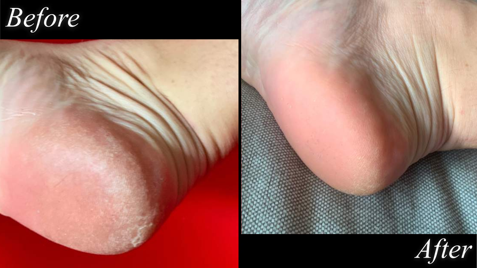 someones feet before and after using the soft services body and feet buffing bar in a before and after format