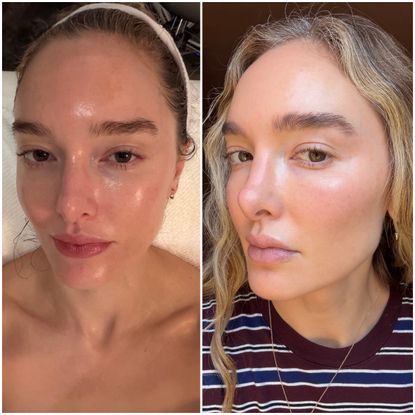 two photos of the same woman, one of a close-up on a facial table with glowy skin, and the next with wavy hair and glowing, flawless skin