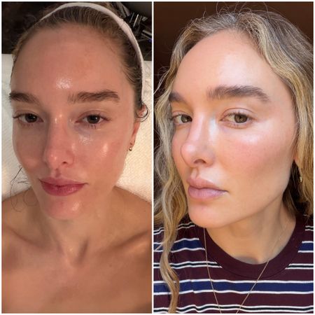 two photos of the same woman, one of a close-up on a facial table with glowy skin, and the next with wavy hair and glowing, flawless skin