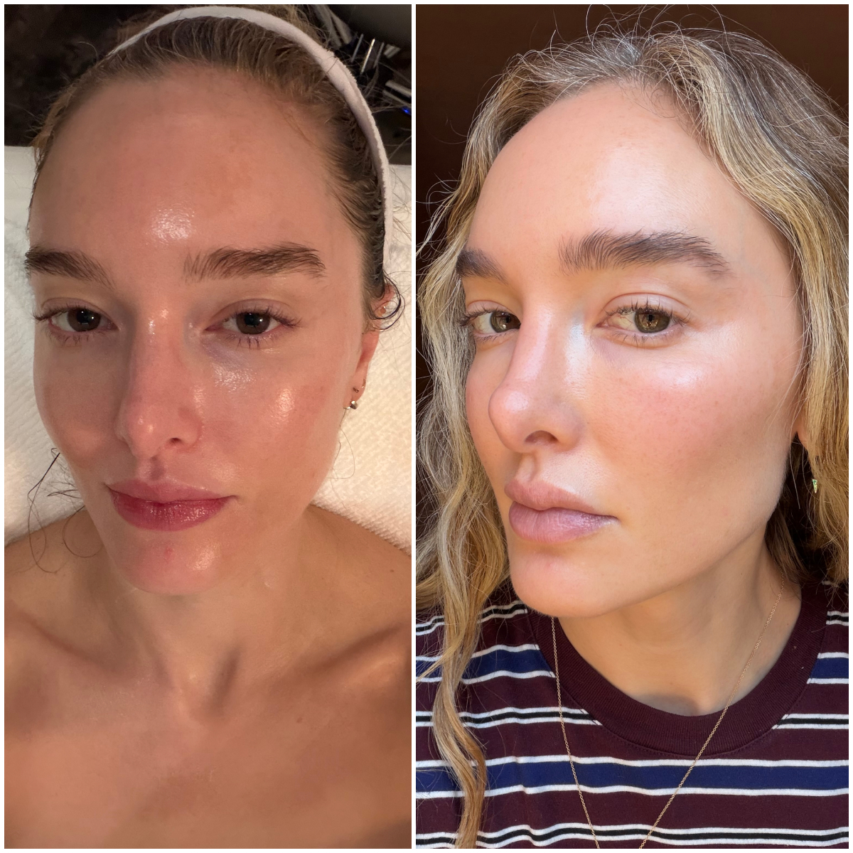 two photos of the same woman, one of a close-up on a facial table with glowy skin, and the next with wavy hair and glowing, flawless skin