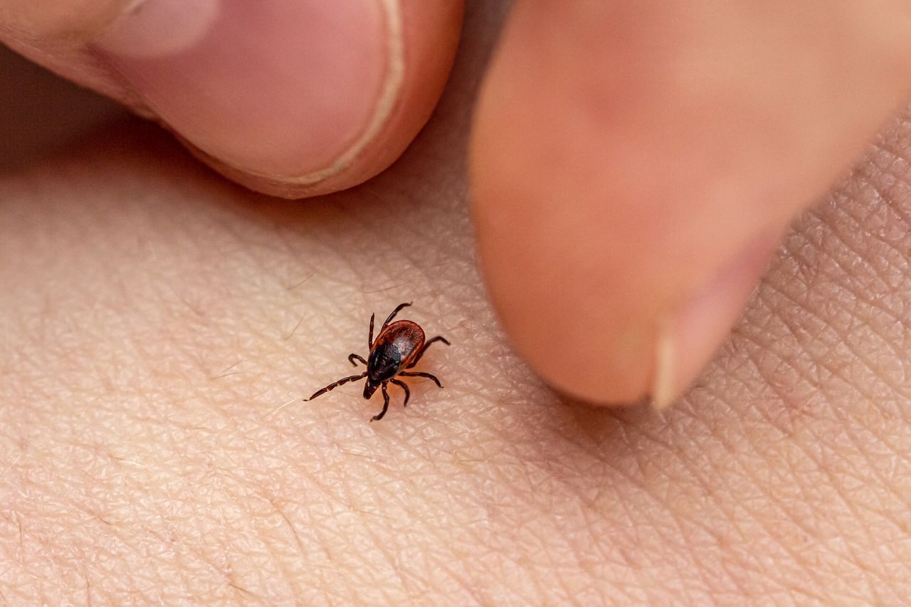 Tick on skin.