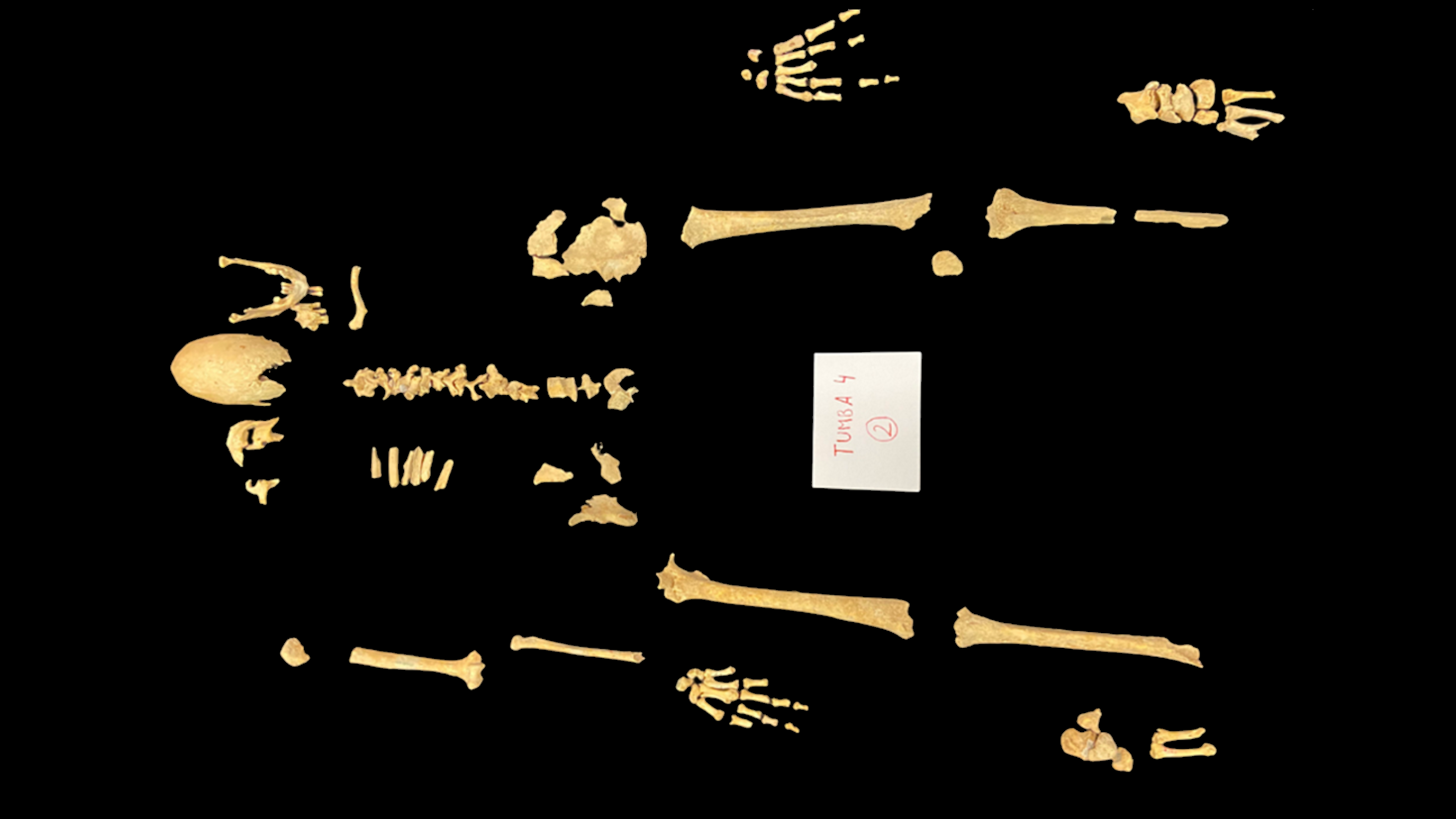 a fragmentary human skeleton laid out in anatomical position against a black background
