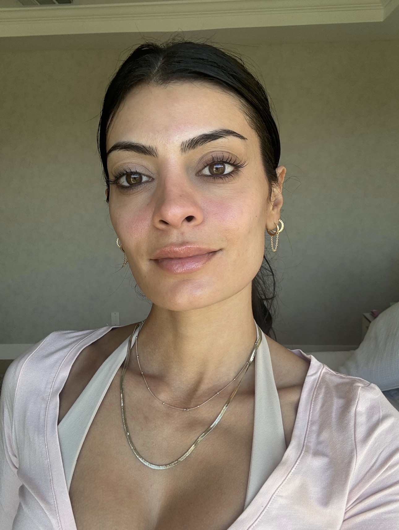 Michelle Rostamian, a woman with dark eyes and dark hair, with bare skin before nanoneedling