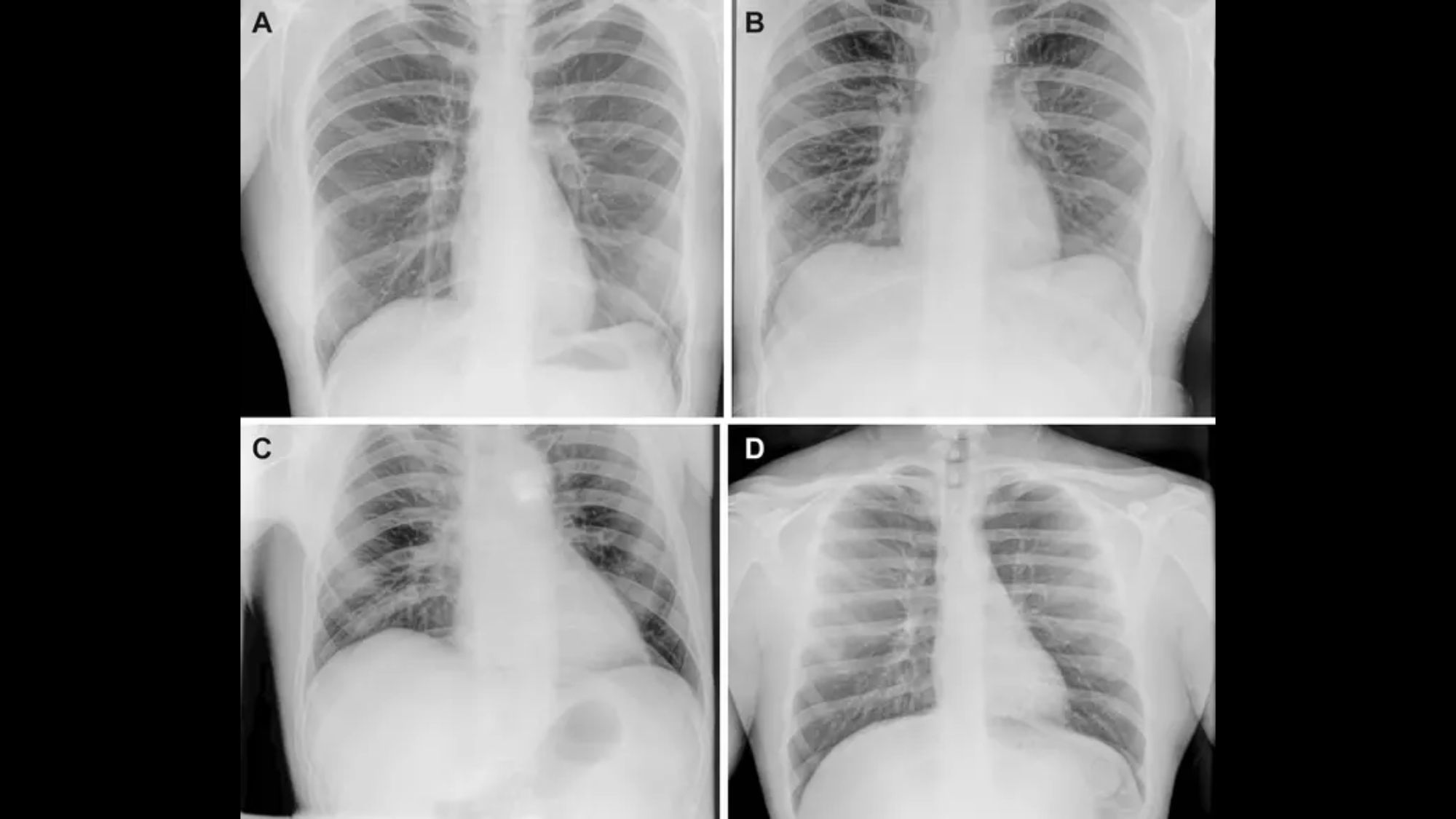 1st-ever X-rays in space offer hope for possible patients headed to the moon 1st-ever X-rays in space offer hope for possible patients headed to the moon