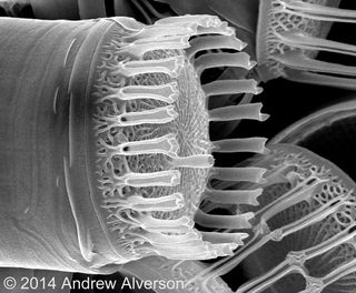 The diatom Skeletonema.