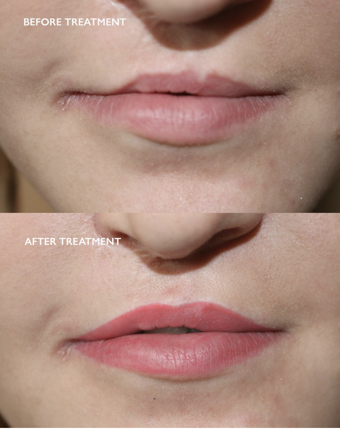 Karen Betts Professional lip blush