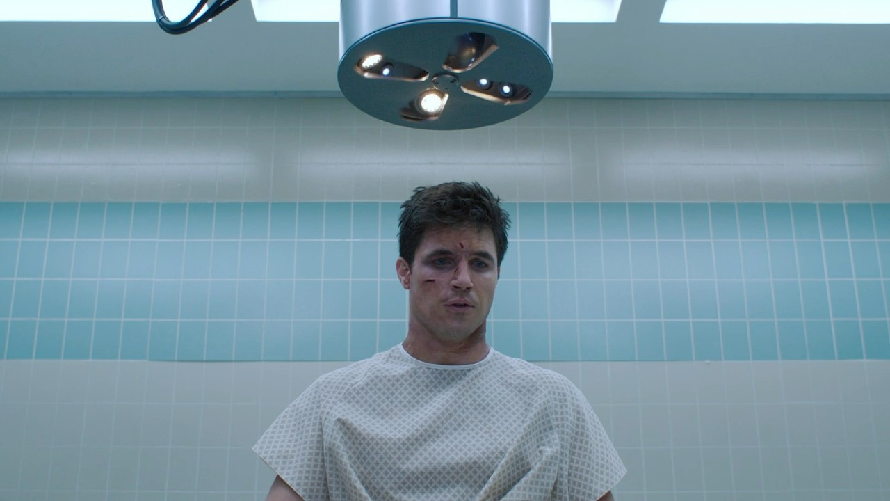 Robbie Amell looking beat up in Upload.
