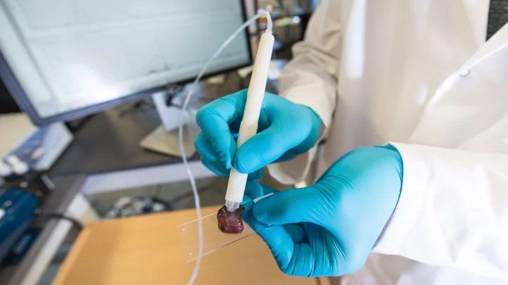 This pen-sized device can identify cancerous cells in seconds | TechRadar