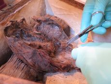 Hair Samples