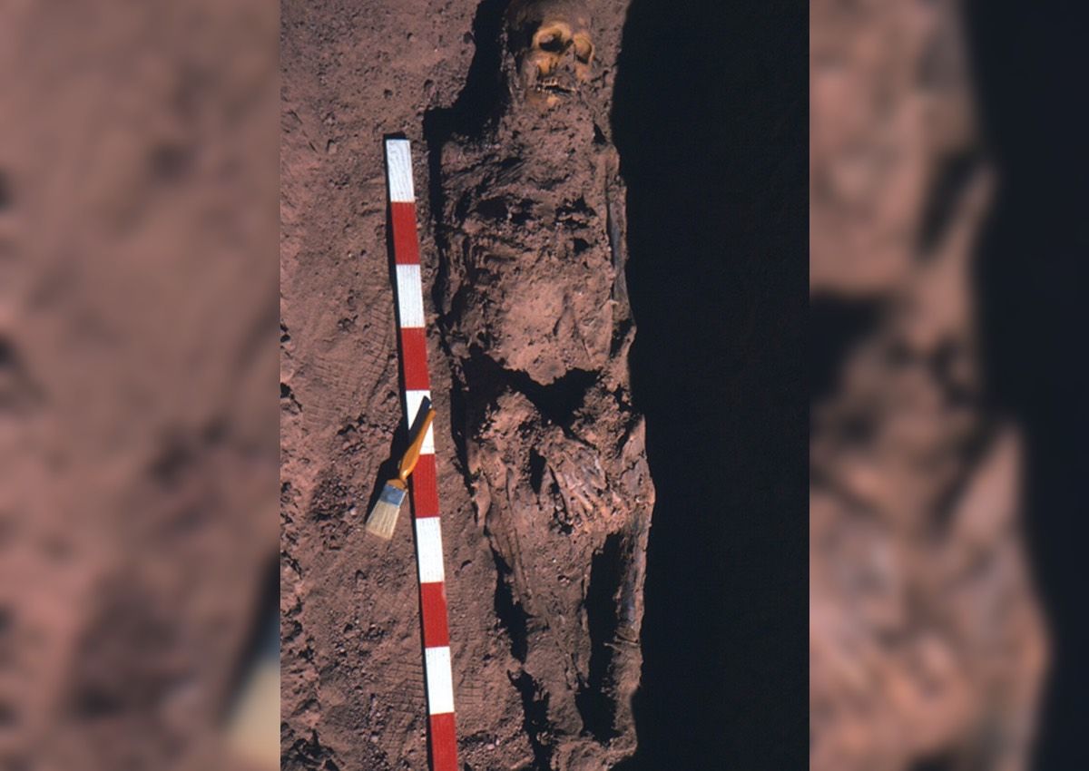 This image show the mummy of an ancient Egyptian man in his 50s who had rectal cancer. 