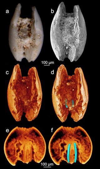 ostracod imagery