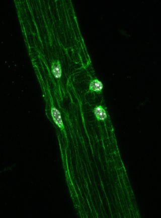 a microscopic image shows a muscle fiber with nuclei assembling near an injury
