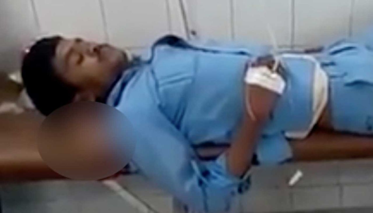 A patient was given his own severed leg to use as a pillow in an Uttar Pradesh hospital