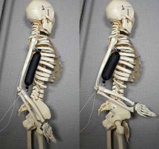 An artificial muscle in use as a bicep lifts a skeleton's arm to a 90 degree position.