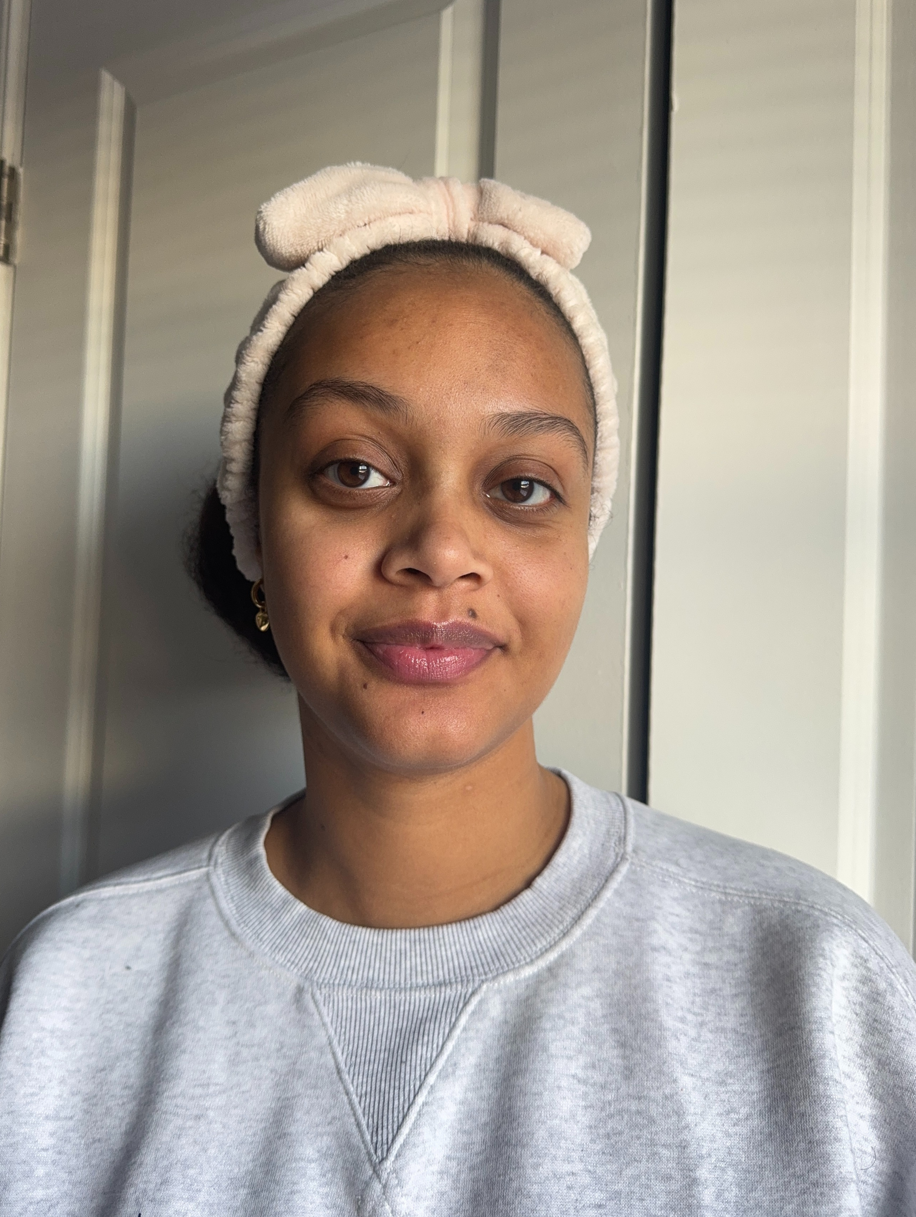 Shauna Beni-Haynes before and after testing Byoma's Hydrating Milky Toner