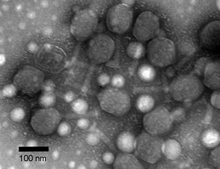 The dark round blobs in this photomicrograph are the capsids of Bacteriophage T4 virus particles, which retain their characteristic shape after being coated with silica. The long, straight "tails" of many of the virus particles can be seen extending from the capsids in this image as well.