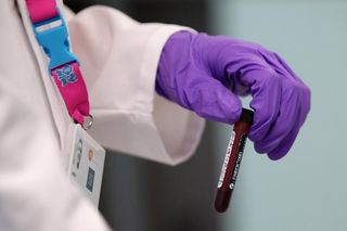 Blood samples in doping control