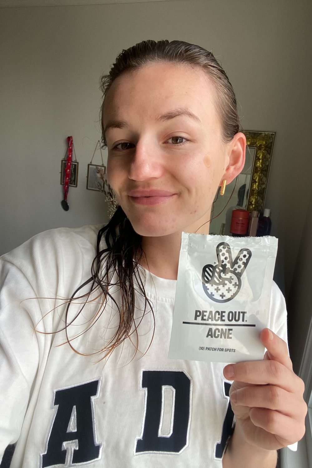 Ally Head wearing Peace Out acne patches