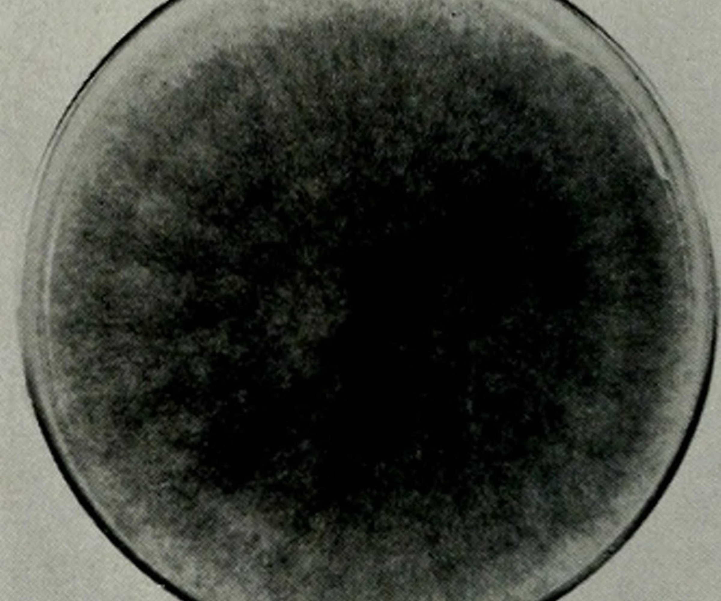 Close-up of Chaetomium