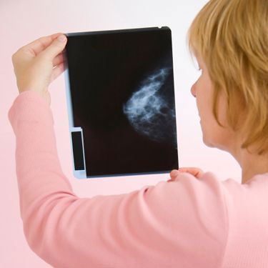 Woman holding up mammogram x-ray