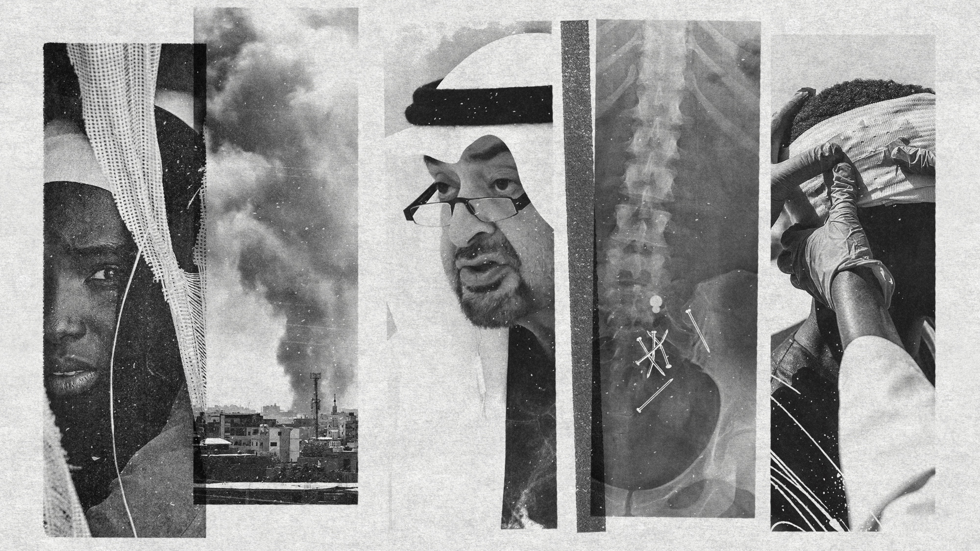 Photo collage of a displaced Sudanese student, smoke rising above Khartoum, President of the UAE Al Nahyan, an x-ray of a human pelvis with nails in it, and a man with a head injury receiving care