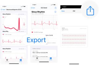 To share the data with your doctor, choose the ECG reading you'd like to share, then tap Export a PDF for your doctor. Choose the share button, then method to share.