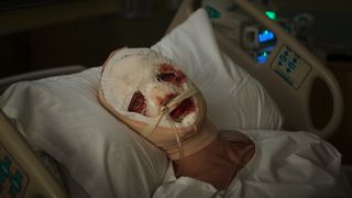 Clayface with bandages on his face