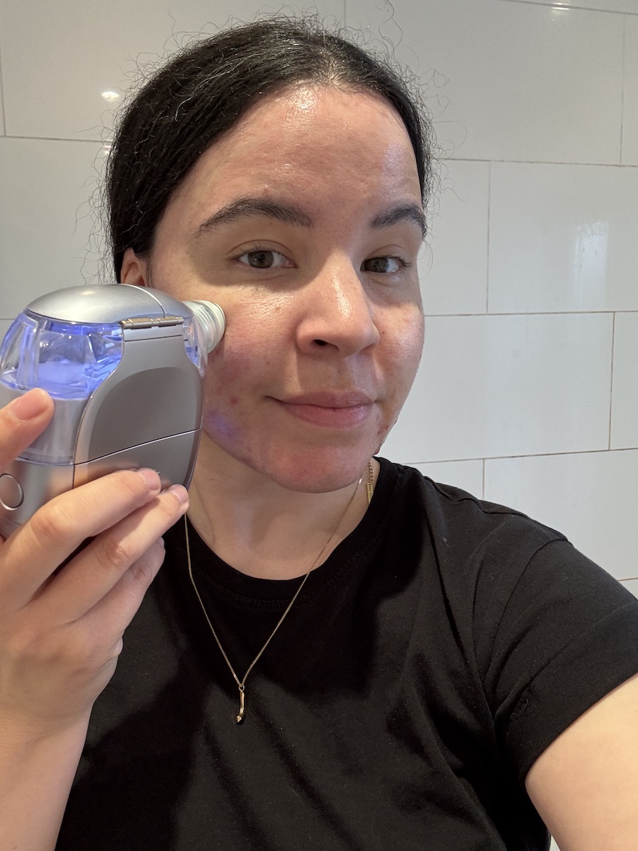 Mica Ricketts using the Shark Beauty Facial ProGlow + DePuffi for extractions and exfoliation