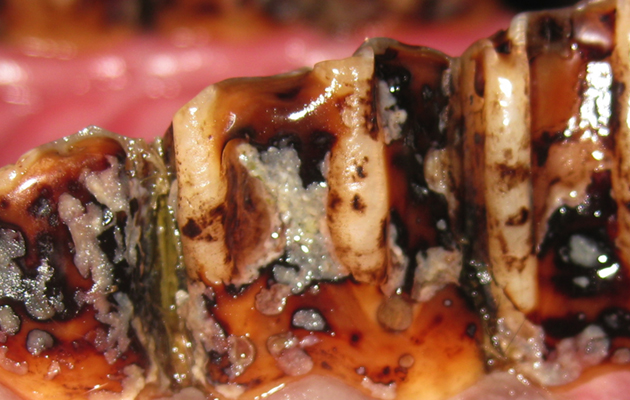 Peripheral caries
