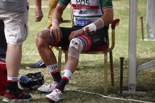 Alexander Kristoff (UAE Team Emirates) suffered deep cuts on his arm and knee after landing on other riders' bikes