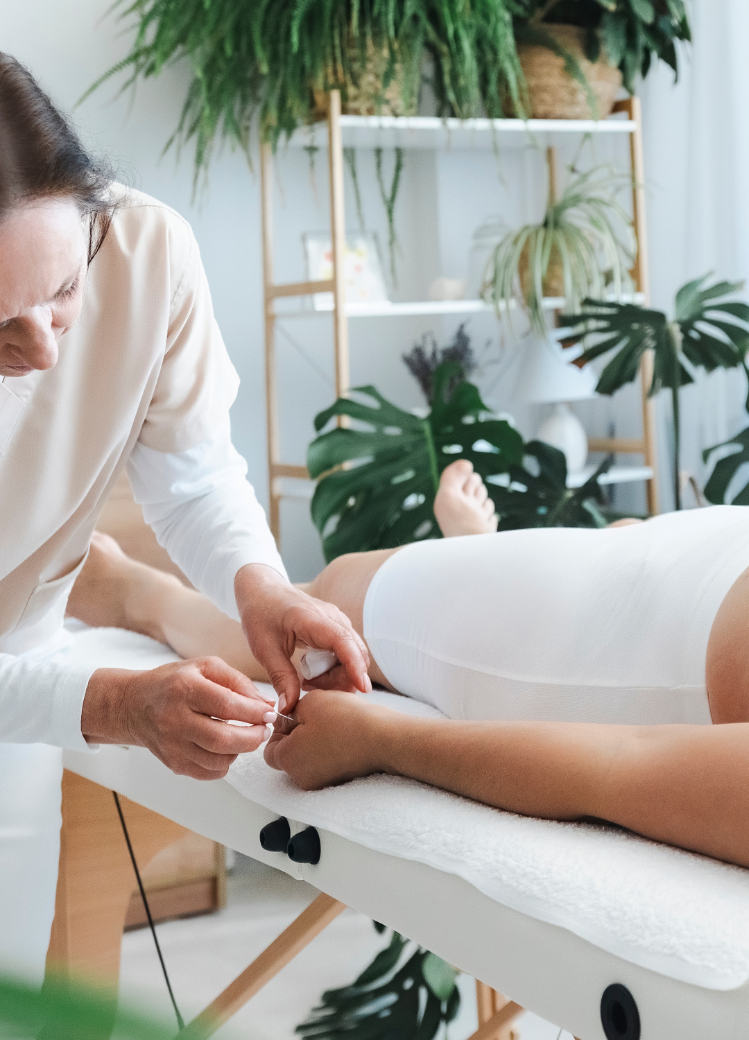Acupuncture