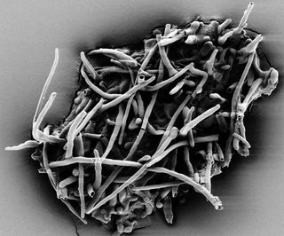 Scanning electron micrograph of fossil ectomycorrhiza leached out of the amber fragment.