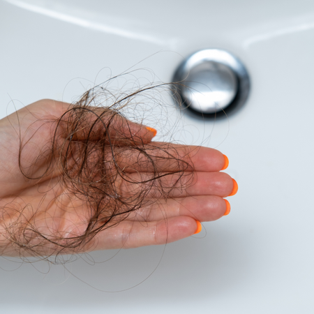 Hair Loss woman's hand over a sink holding strands of hair that have fallen out