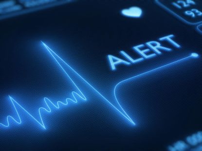 Study: Heart attacks are deadlier for younger women