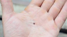 The tick ixodes scapularis, also called black-legged tick or deer tick, can infect people with the potentially fatal Powassan virus.