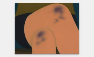 painting of bruised knees