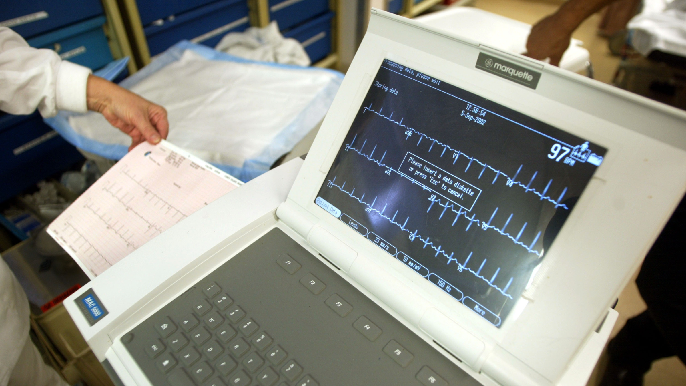 Monitor with fluctuating lines.