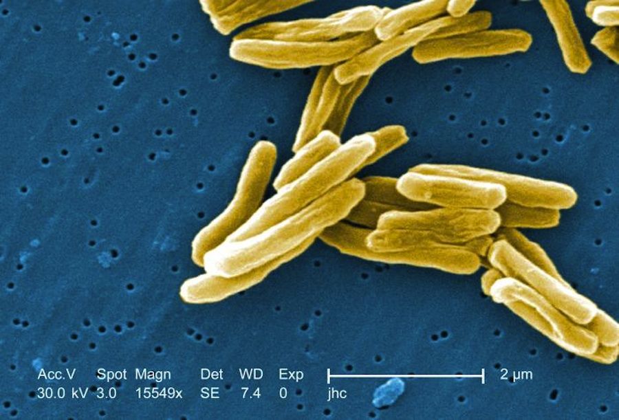 Scanning Electron Micrograph of Tuberculosis 