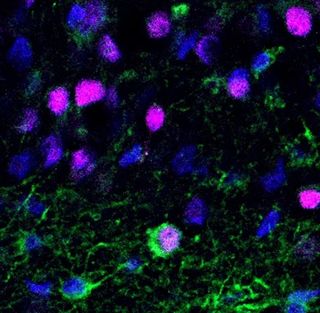 una imagen microscópica de neuronas