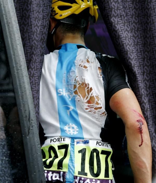 Richie Porte (Sky) boards his team bus with the effects of three crashes on display.