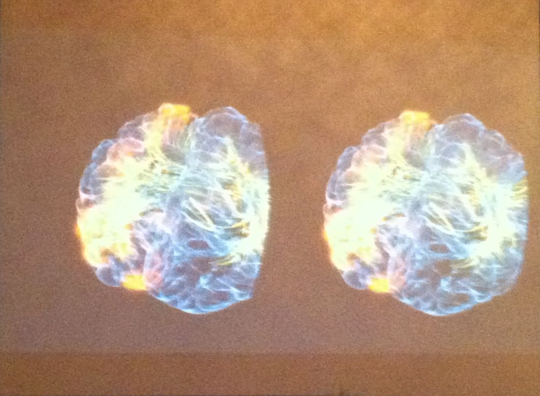 a projection screen showing the interior of a brain in real-time.