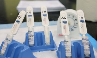 HIV test swabs incubating in New York: The American Academy of Pediatrics has changed its guidelines, and now recommends that all teens aged 16 to 18 get tested for HIV if they live in high-r