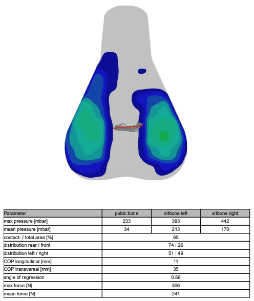 A visual output of saddle pressure mapping
