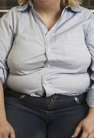 Obese woman in sloppy clothes.