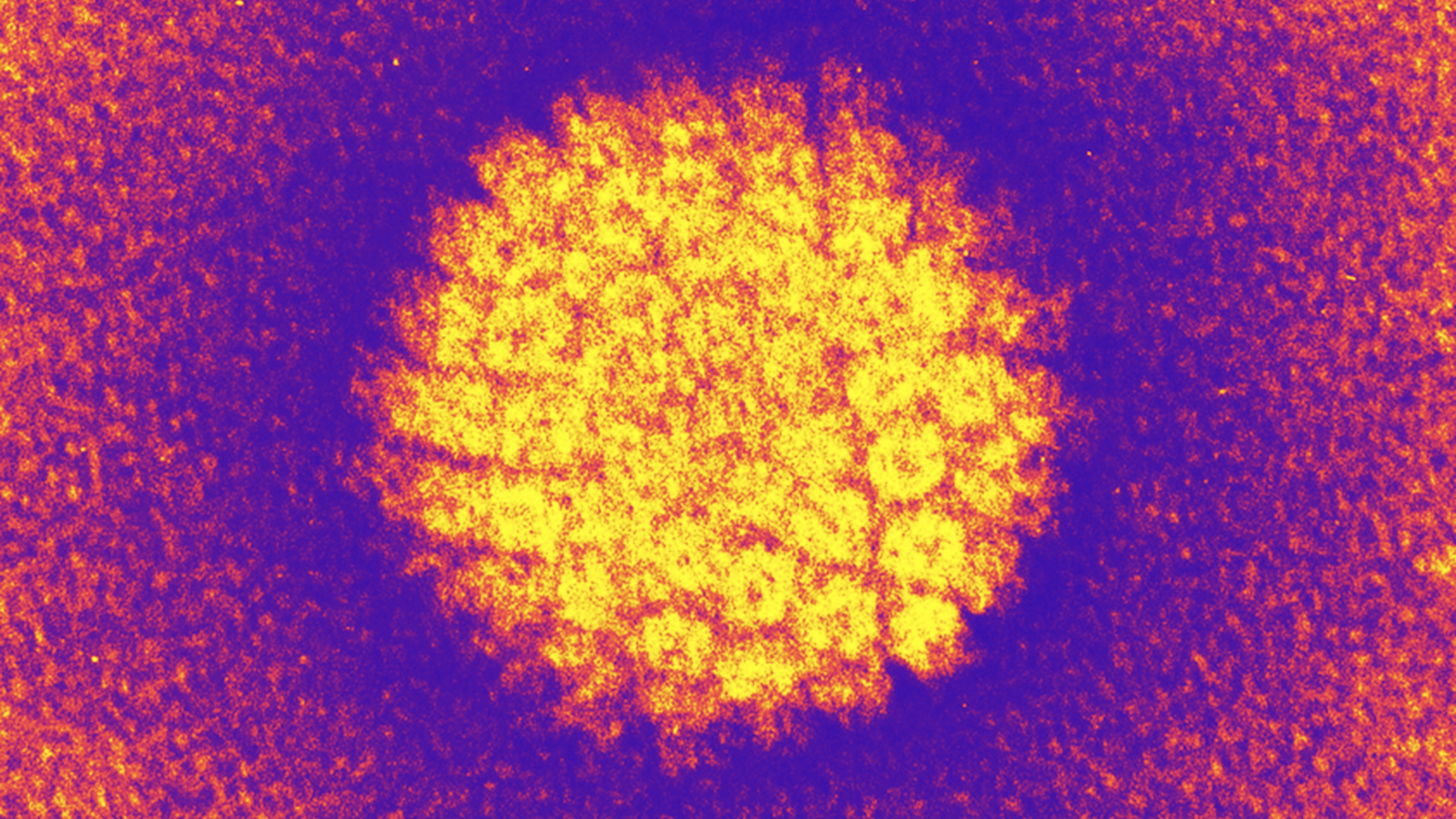 An image of HPV from a coloured transmission electron micrograph.